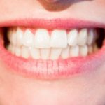 Prześliczne nienaganne zęby dodatkowo powalający prześliczny uśmiech to powód do dumy.